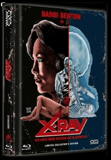 X-Ray - Der erste Mord geschah am Valentinstag (Limited Mediabook, Blu-ray+DVD, Cover B) (1982) [FSK 18] [Blu-ray]